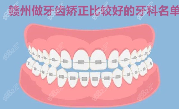 赣州做矫正比较好的牙科名单