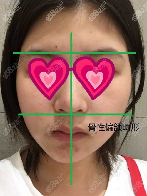 面部不对称图片