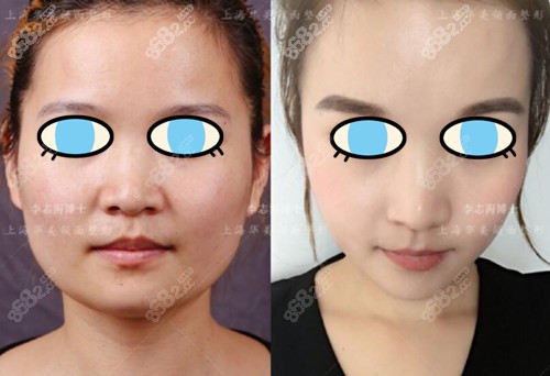 他磨骨的风格和技术详解