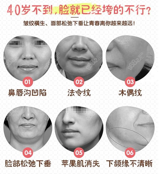 大拉皮手术适合哪些人做