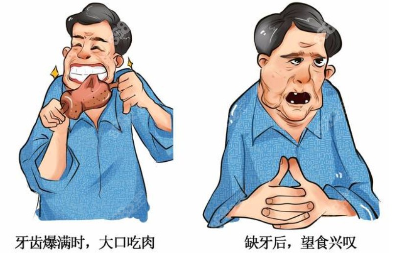 重庆种植牙技术<span style=