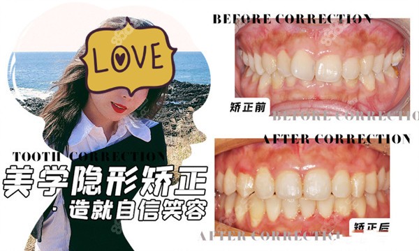 佛山雅度口腔