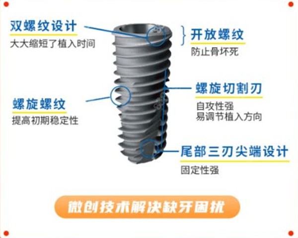 西安诺贝尔美国进口牙体优势