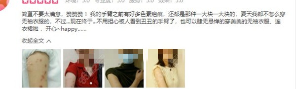 疤痕患者評價