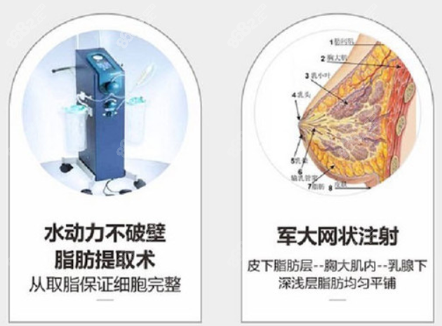 <!--<i data=20240705-sp></i>-->脂肪提取技术特点