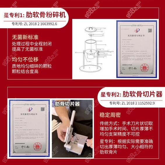 周顺波医生做肋骨鼻时采用的技术