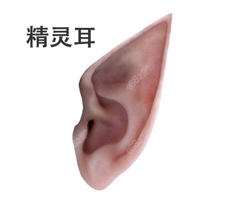  精靈耳釘特征樣子