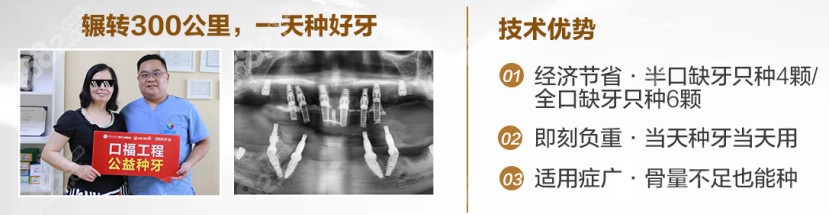 成都新桥的种植牙病例