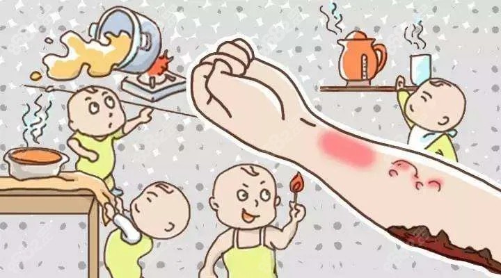 上海烧烫伤疤痕修复去哪家