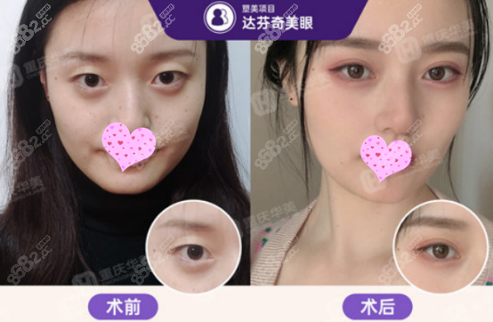 重庆华美眼综合效果图