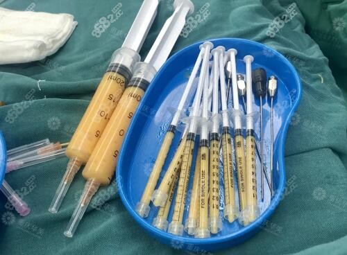 重庆华美做自体脂肪全脸填充哪位医生好