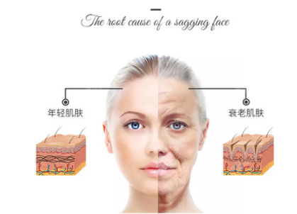 穆宝安拉皮价格
