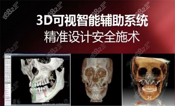 3D可视智能辅助系统