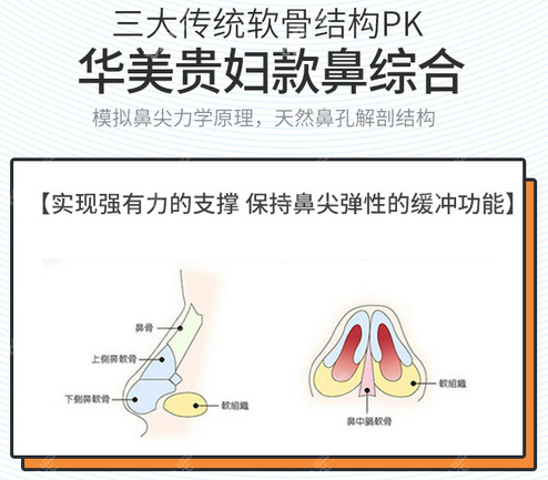 曹海峰医生贵妇款鼻综合