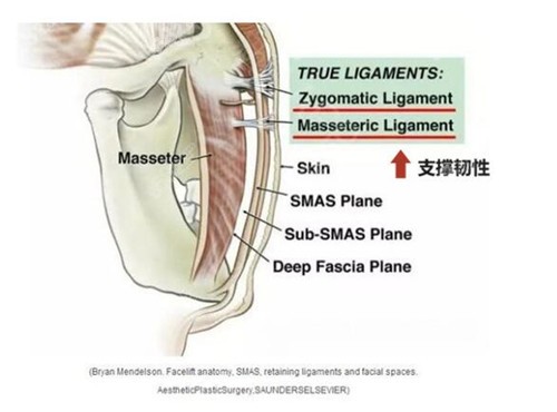 柳民熙拉皮提升的支撑韧带