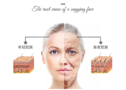 做拉皮手术哪个医生好呢？