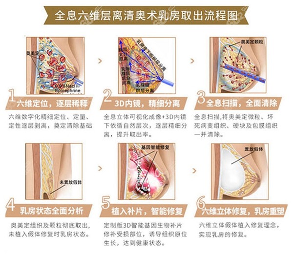 广州荔湾<!--<i data=20240705-sp></i>-->奥美定取出流程