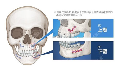 上颌下颌的位置图片图片