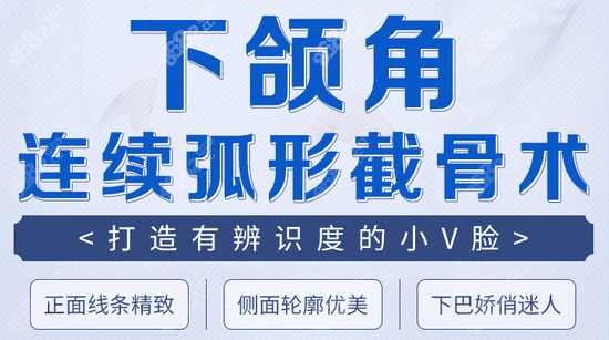 罗金超的下颌角连续弧线截骨手术特点宣传图