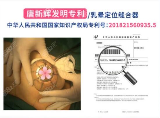 深圳富华医院假体隆胸技术优势