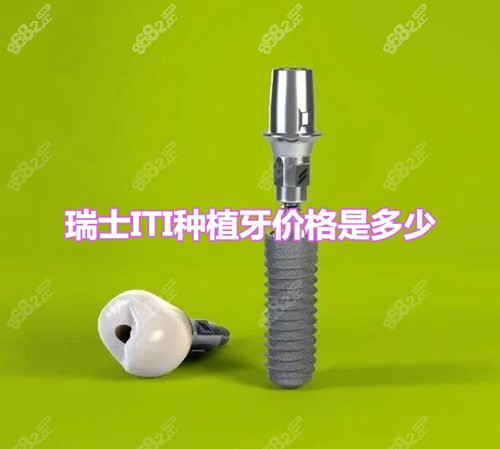 郑州瑞士ITI种植牙大概多少钱一颗