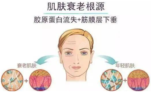 上海拉皮手术价格是多少呢？