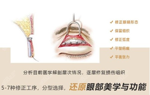 重庆星荣整形医院眼修复特色