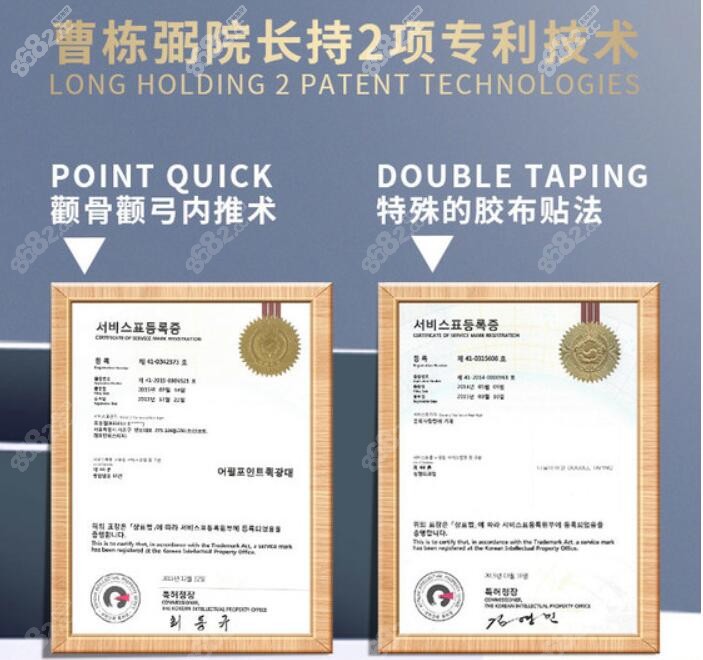 上海美联臣颧骨内推技术优势