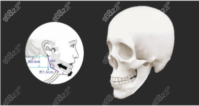 做下頜角可行嗎？