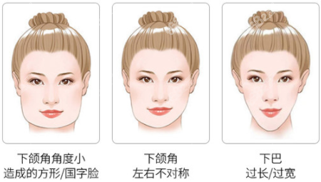 磨骨怎么樣呢？