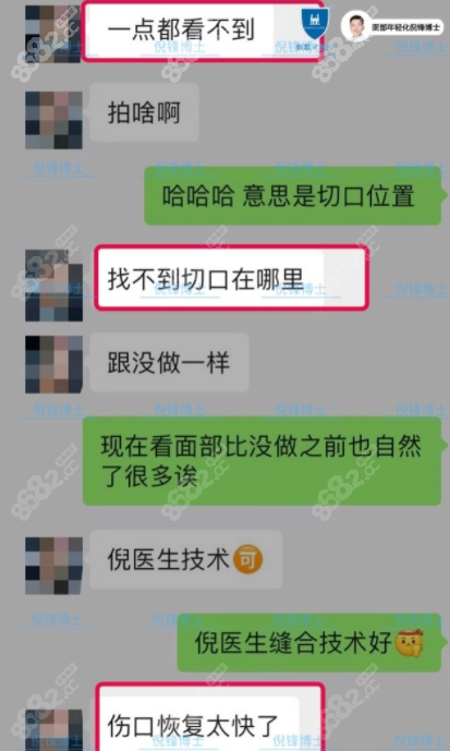 倪锋医生拉皮术后的评价