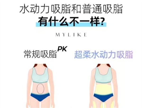 云南华美美莱New水动力吸脂
