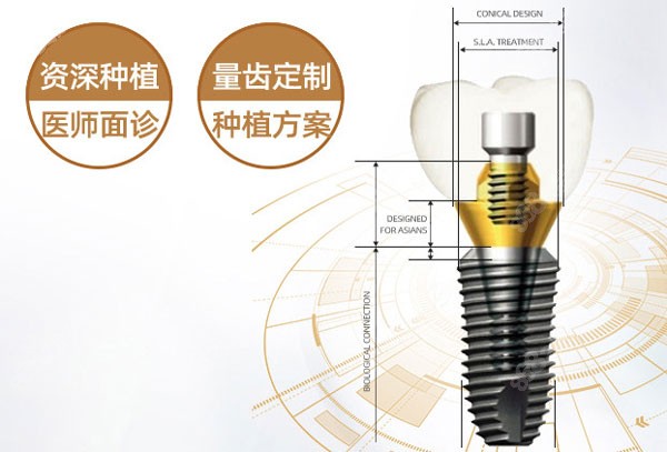 3999元或4000元一颗的种植牙靠谱吗 3999元或4000元一颗的种植牙靠谱吗