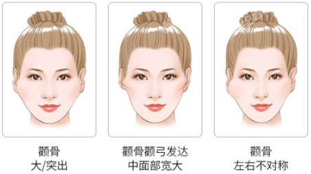 張柱允醫(yī)生磨骨技術(shù)精湛