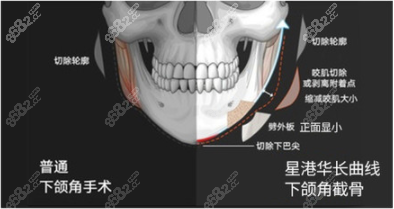 張柱允在那幾醫(yī)院坐診呢？