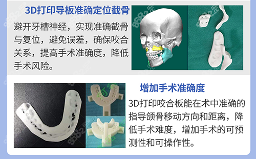 何锦泉正颌技术好