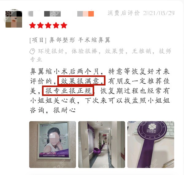 顾客对张效恩医生做鼻子的效果挺满意