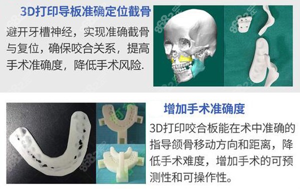 广大做双鄂采用3D数字化手术