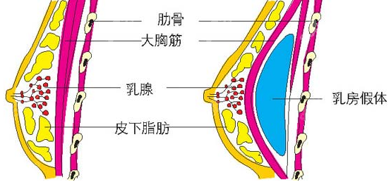 深圳美莱隆胸好的医生都有谁呀？