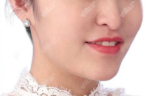 找<!--<i data=20240705-sp></i>-->做完速提美后照片