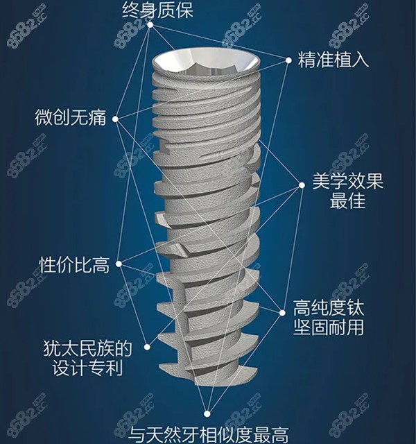 以色列科特斯cortex种植体怎么样