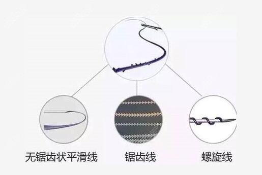 不同的埋线提升材料