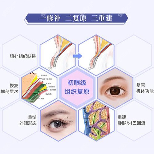 师丽丽医生做眼修复的原理