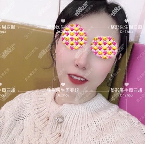 上海面部脂肪填充靠谱医生