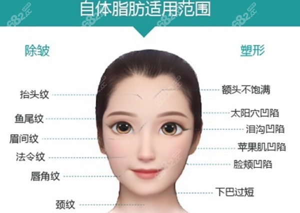 杭州同荣丽格做自体脂肪填充全脸的所有部位