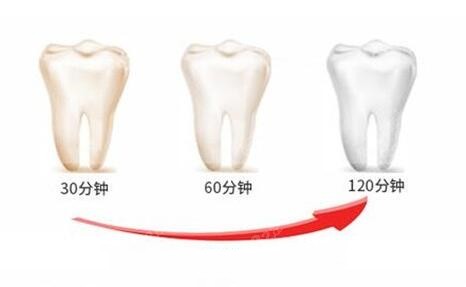 现在做牙齿美白先进的技术是什么