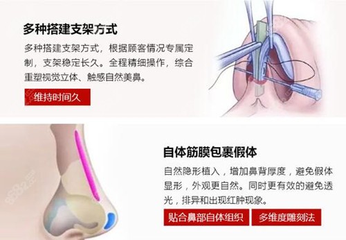 黄寺杜太超隆鼻优势