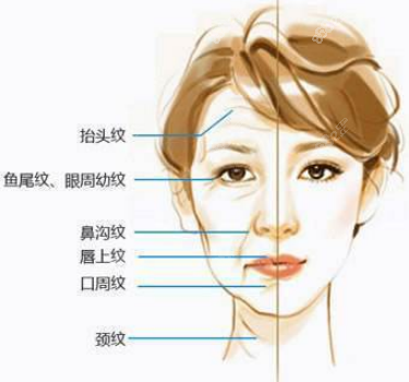 20多岁脸部出现了下垂等情况