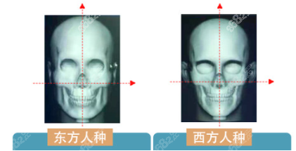 医疗集团东篱医院整形美容截骨