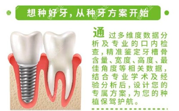 上海鼎植种植牙优势